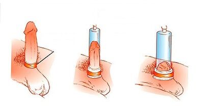 O principio de funcionamento da bomba para aumentar o pene